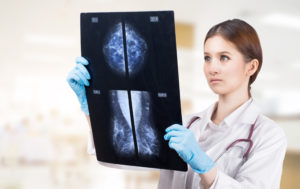 What is the Difference between a Screening Mammogram and a Diagnostic Mammogram?