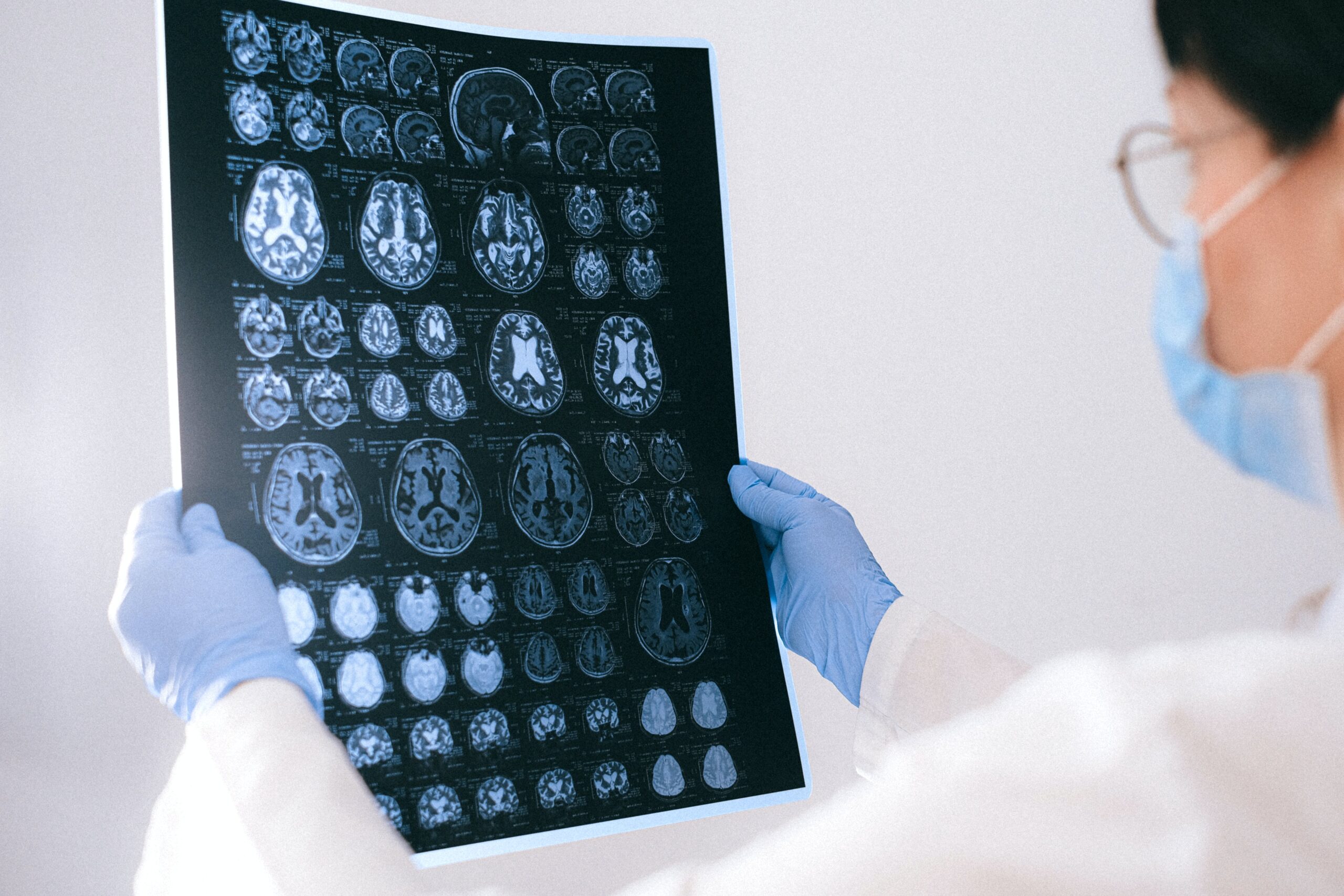 Doctor examining a brain scan